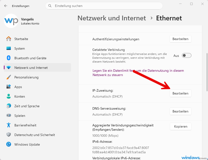 IP zuweisung
